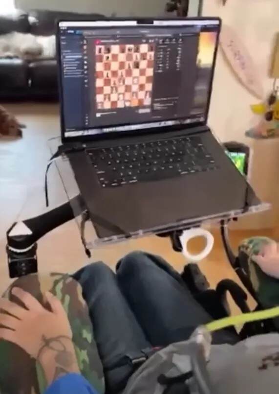 让患者用意念打游戏，除了马斯克Neuralink，他们也能做到